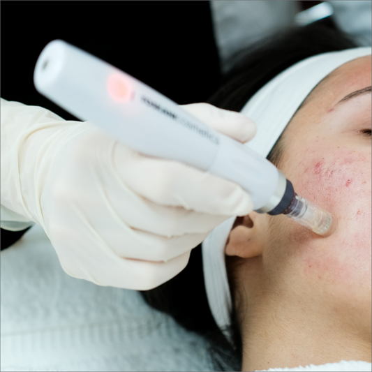 Microneedling